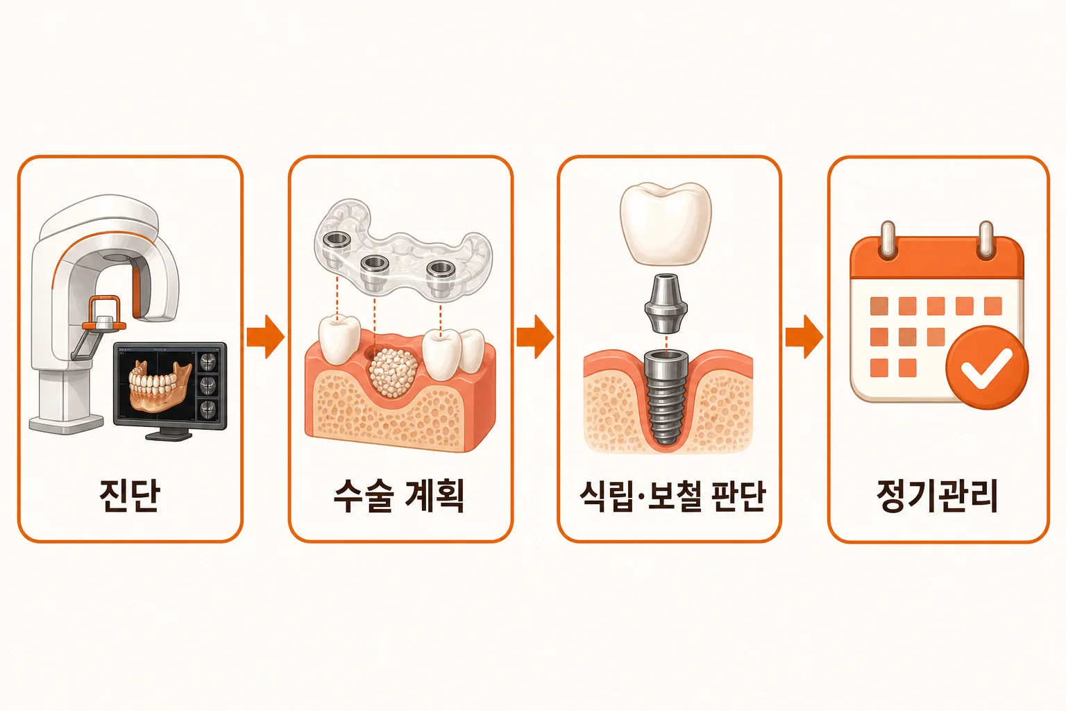 임플란트 진단부터 정기관리까지 4단계 인포그래픽 | 진단, 수술 계획, 식립·보철 판단, 정기관리