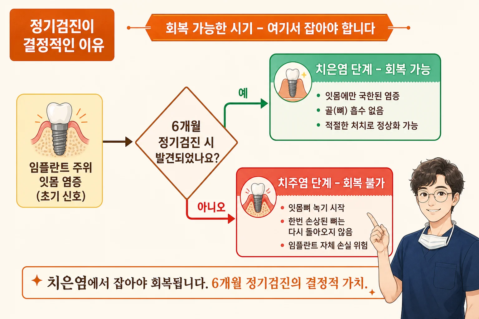 임플란트 주위 점막염과 잇몸뼈 소실을 동반한 주위염의 단계 비교