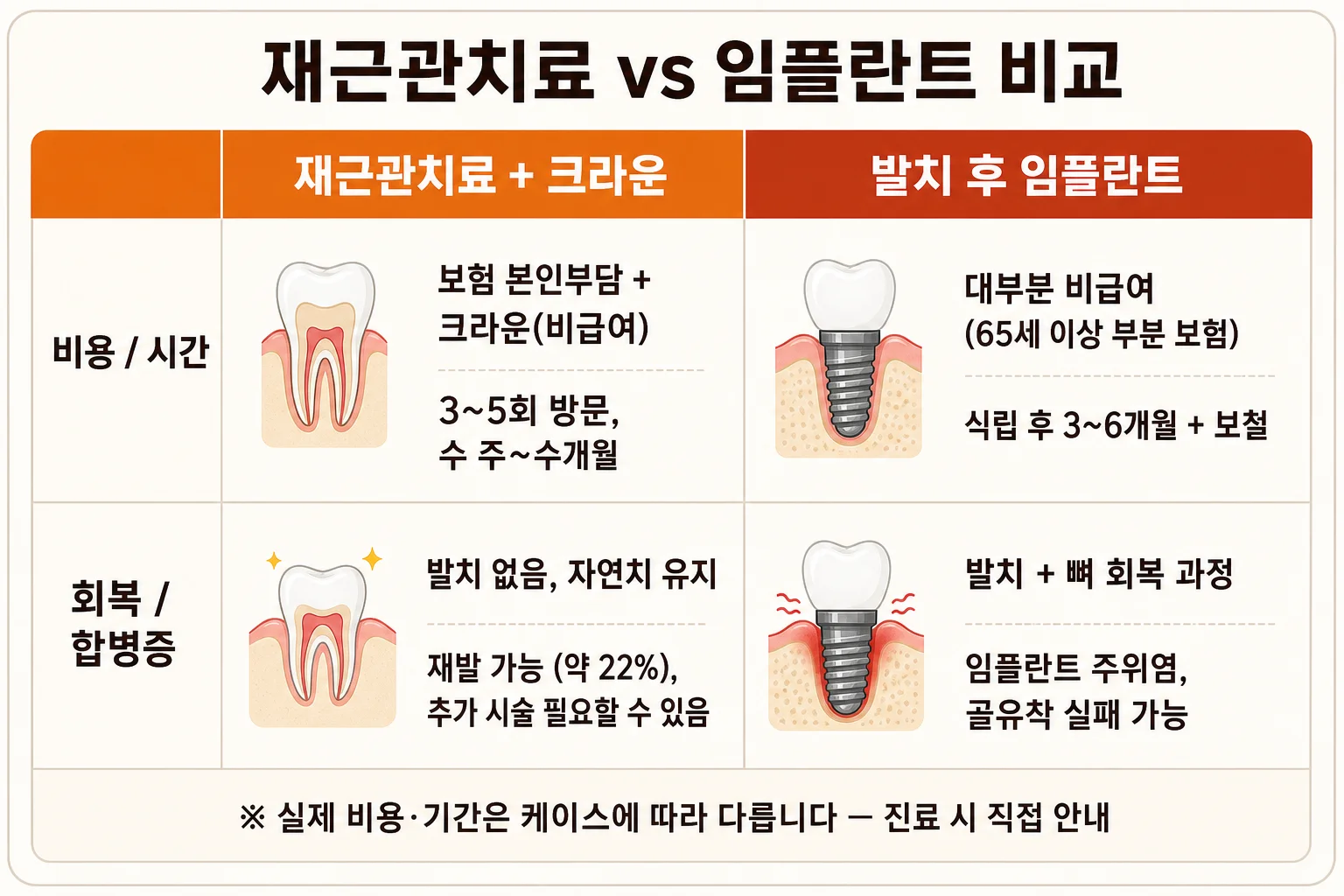재근관치료와 발치 후 임플란트를 비용·시간·회복·재실패 4개 항목으로 비교한 표