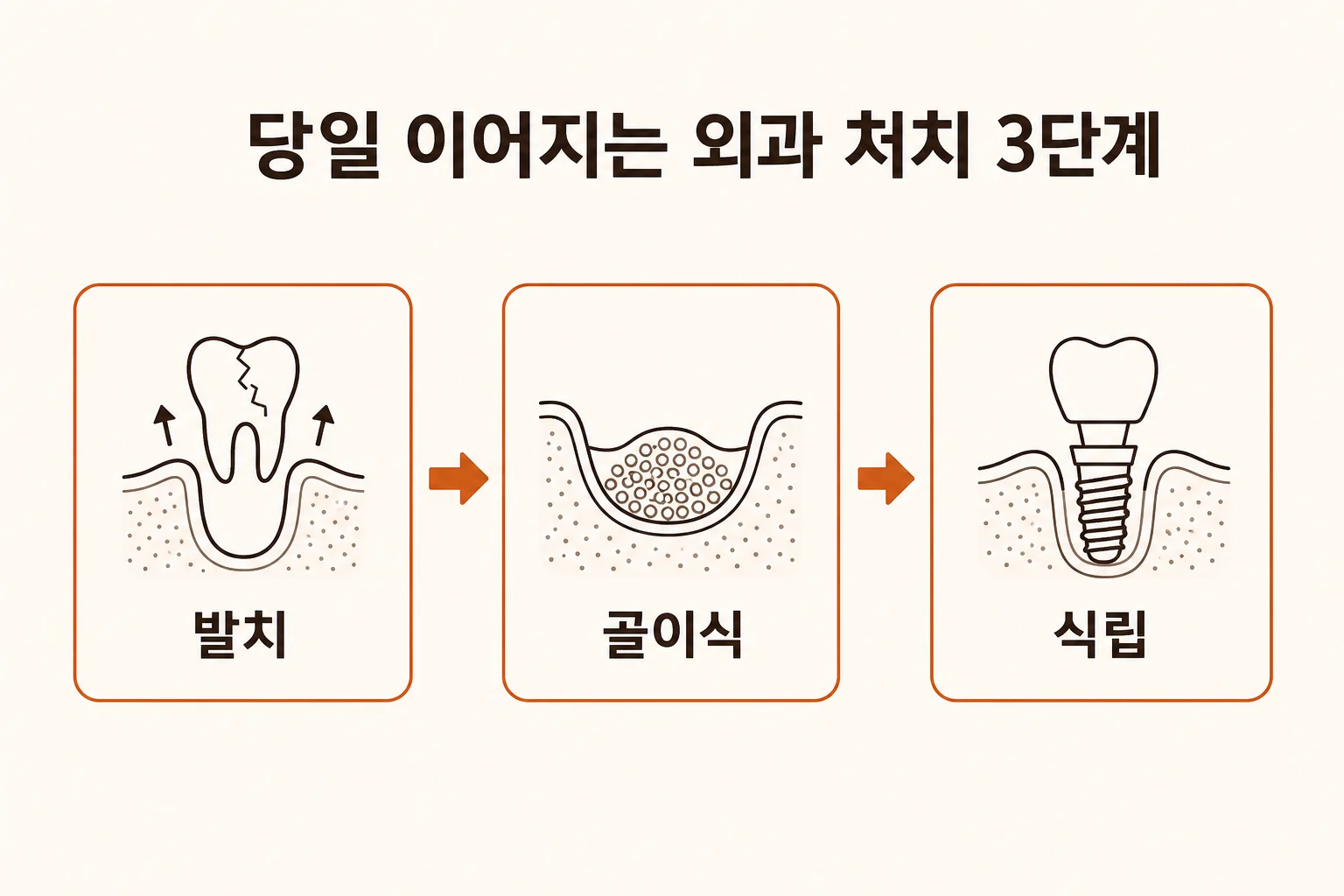 당일 이어지는 외과 처치 3단계 - 발치, 골이식, 식립