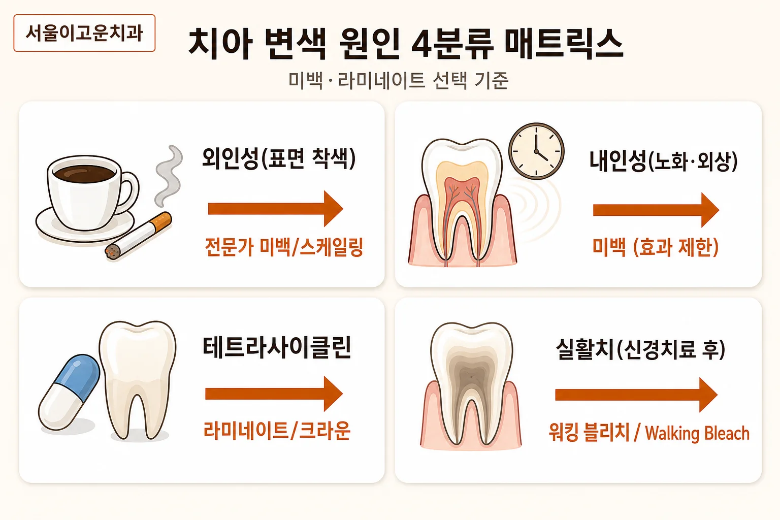 미백과 라미네이트 | 변색 원인별 선택 기준 | 파주 서울이고운치과 내용을 설명하는 치과 진료 이미지