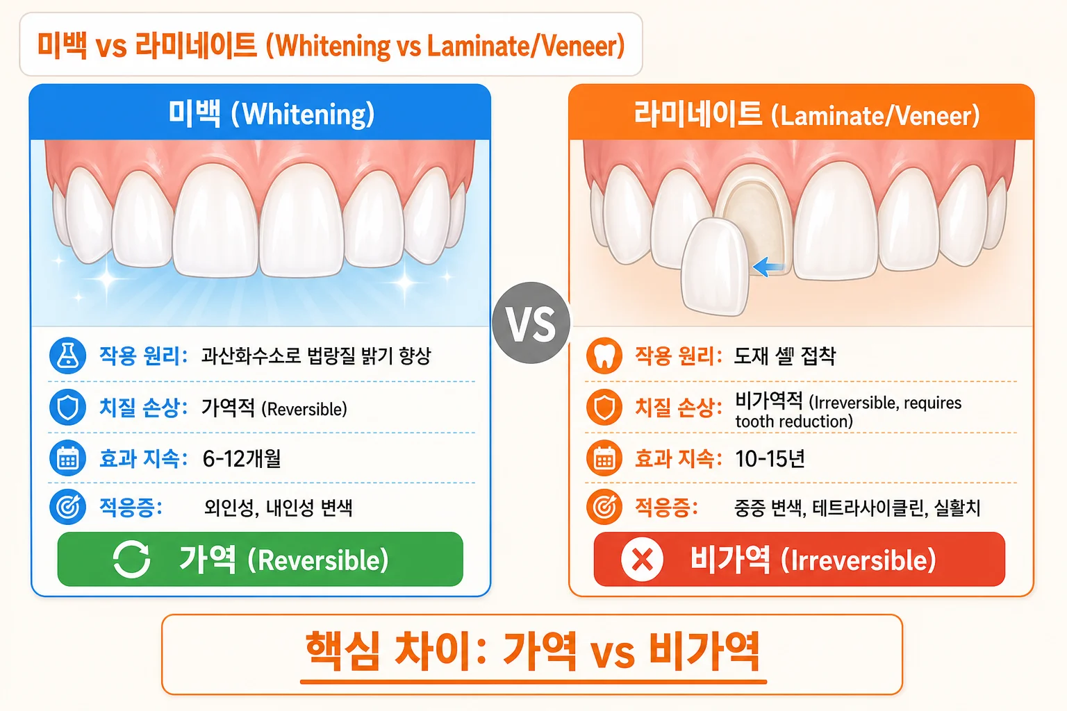미백과 라미네이트의 작용 원리, 치질 삭제 가능성, 유지 기간과 적응증을 비교한 안내