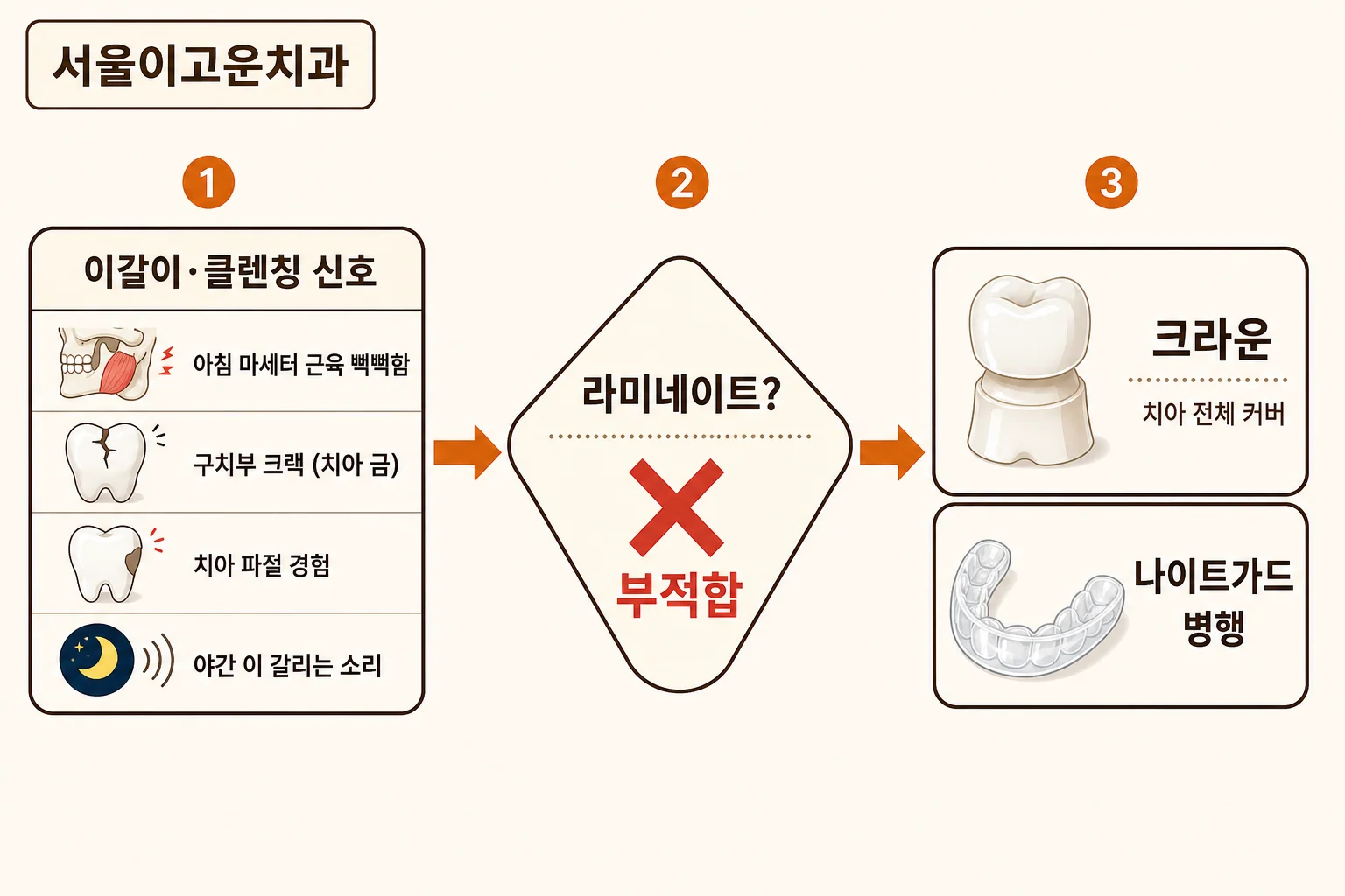 이갈이와 클렌칭이 있는 환자에서 지르코니아 크라운과 나이트가드를 검토하는 기준