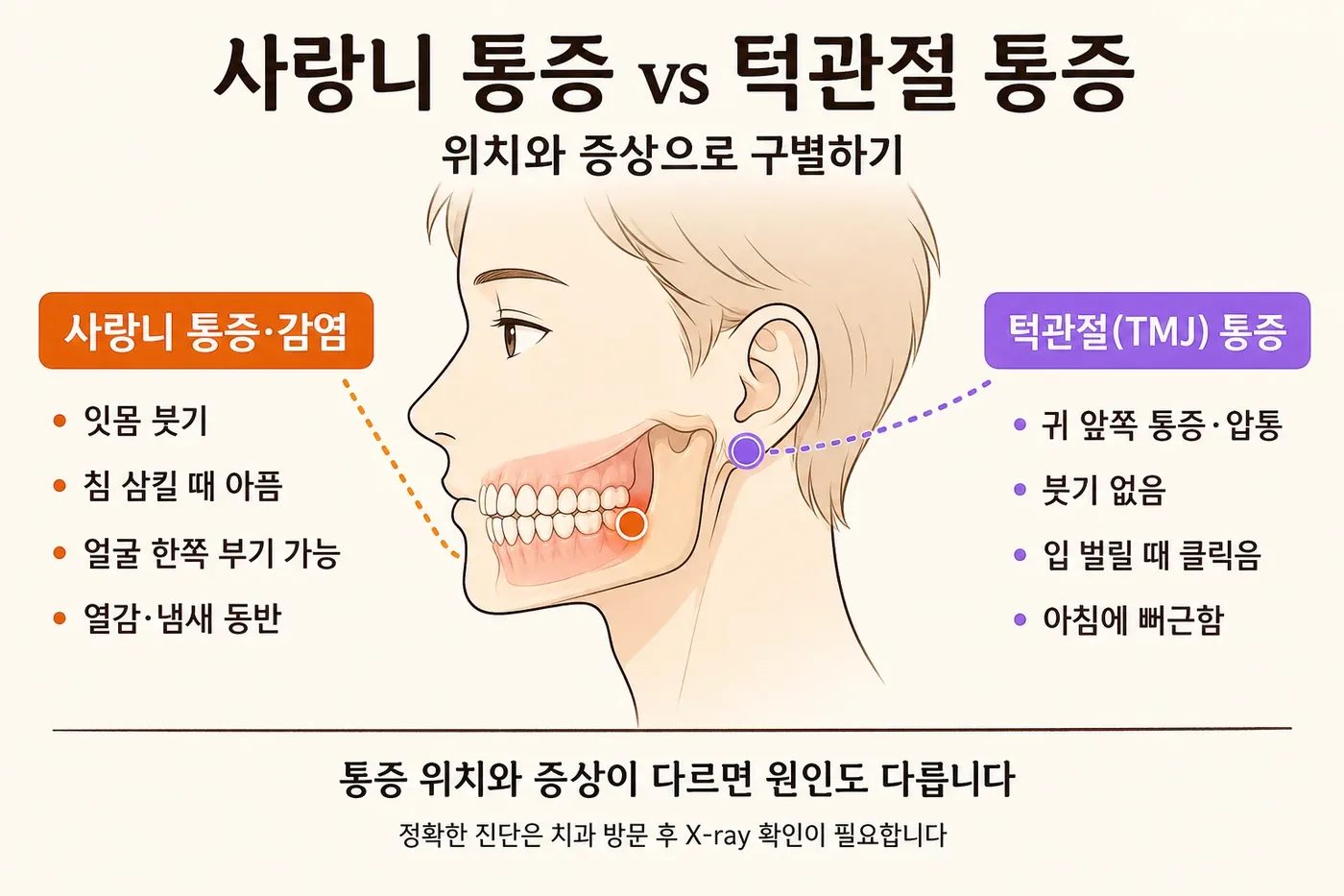 사랑니 감염과 턱관절 통증을 위치·붓기·연하통 기준으로 구분한 감별 인포그래픽