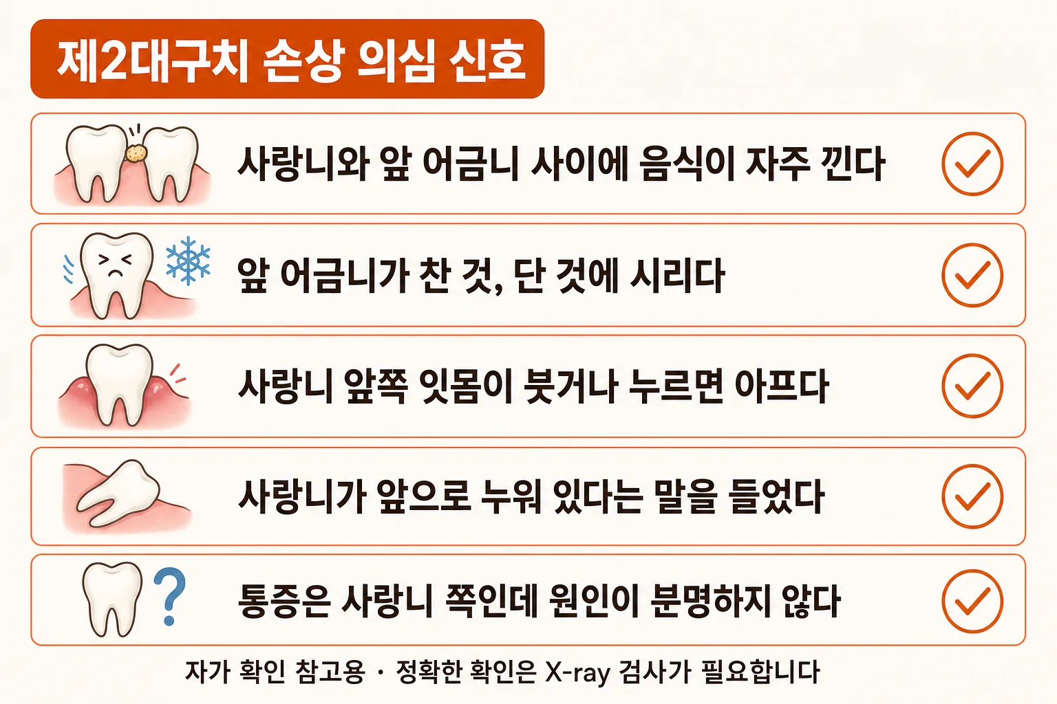 제2대구치 손상을 의심할 수 있는 신호를 사랑니와 앞 어금니 사이 음식물 낌, 시림, 잇몸선 통증 항목으로 정리한 체크 인포그래픽