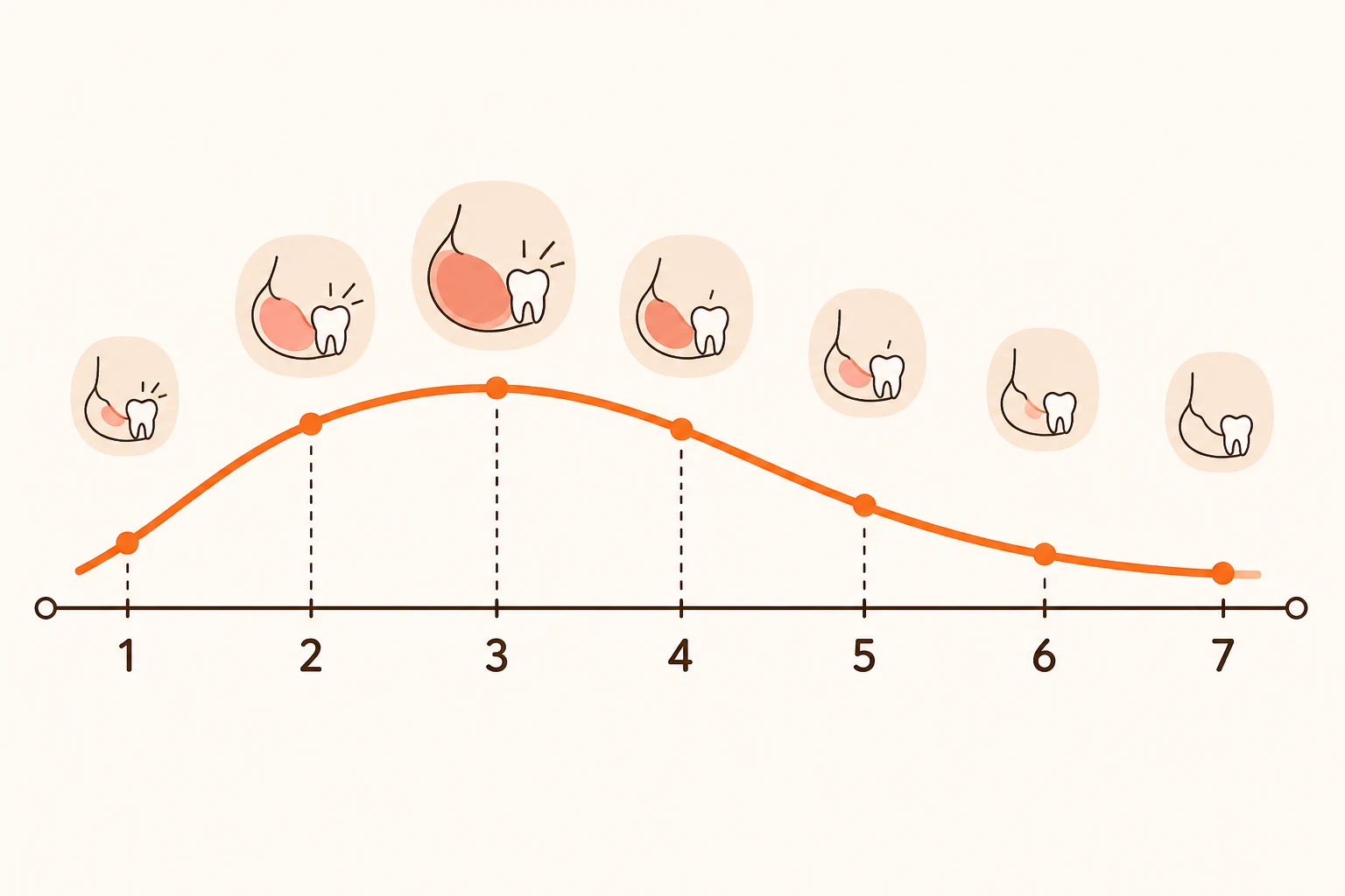 사랑니 빼고 붓기 며칠까지 정상일까 | 48~72시간 판단 기준 | 파주 서울이고운치과 내용을 설명하는 치과 진료 이미지